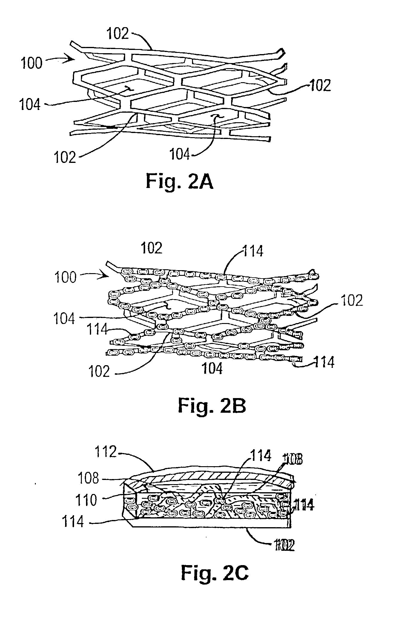 Inhibition of restenosis using a DNA-coated stent