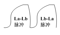 Digital leakage current detection circuit and detection method thereof