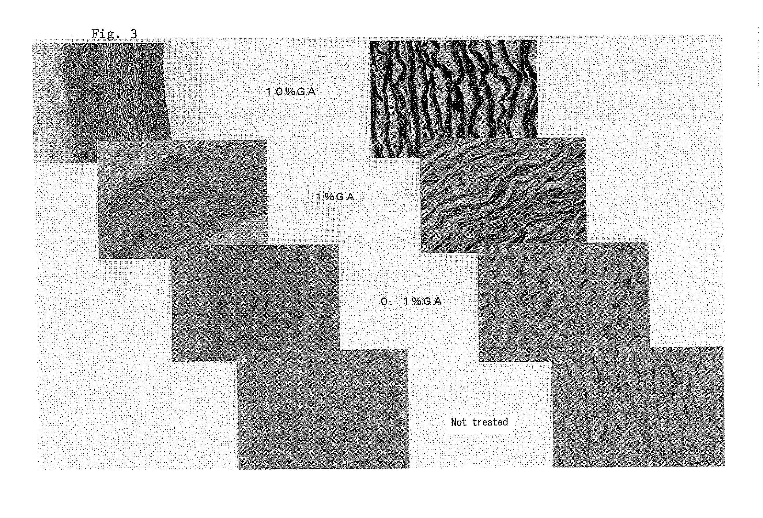 Method for preparing biological scaffold material