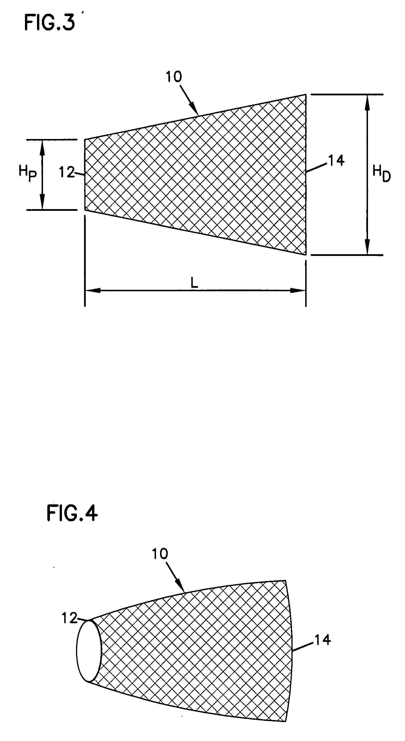 Tongue implant