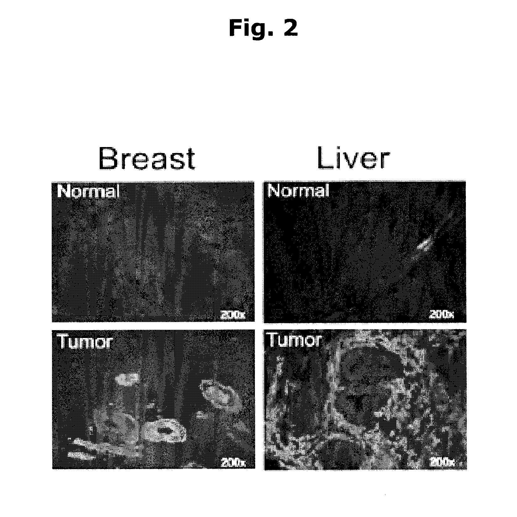 Use of nibp polypeptides