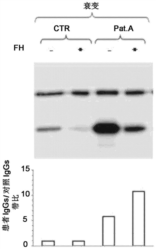 Method for the diagnosis of c3nef-mediated membranoproliferative glomerulonephritis