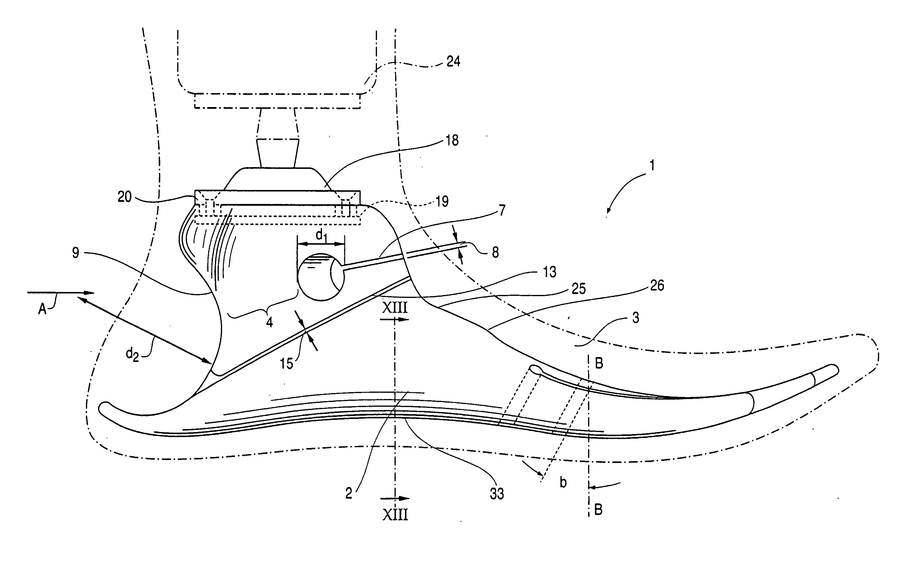 Prosthetic foot