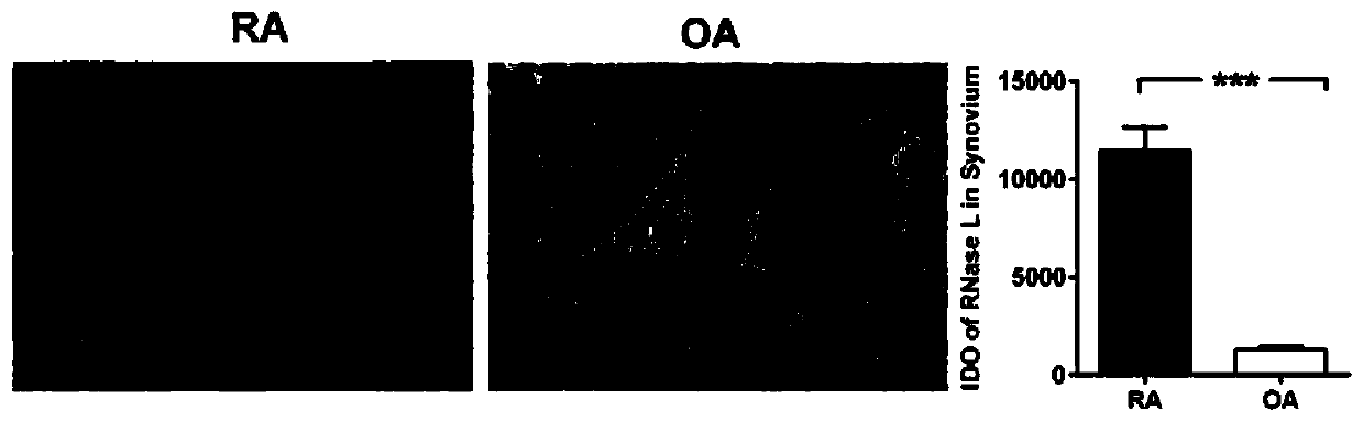 Diagnostic marker of rheumatoid arthritis and application thereof