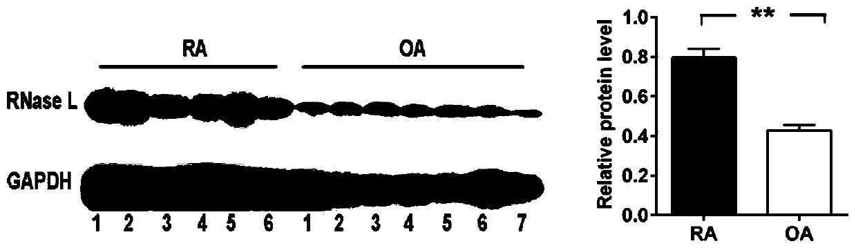 Diagnostic marker of rheumatoid arthritis and application thereof