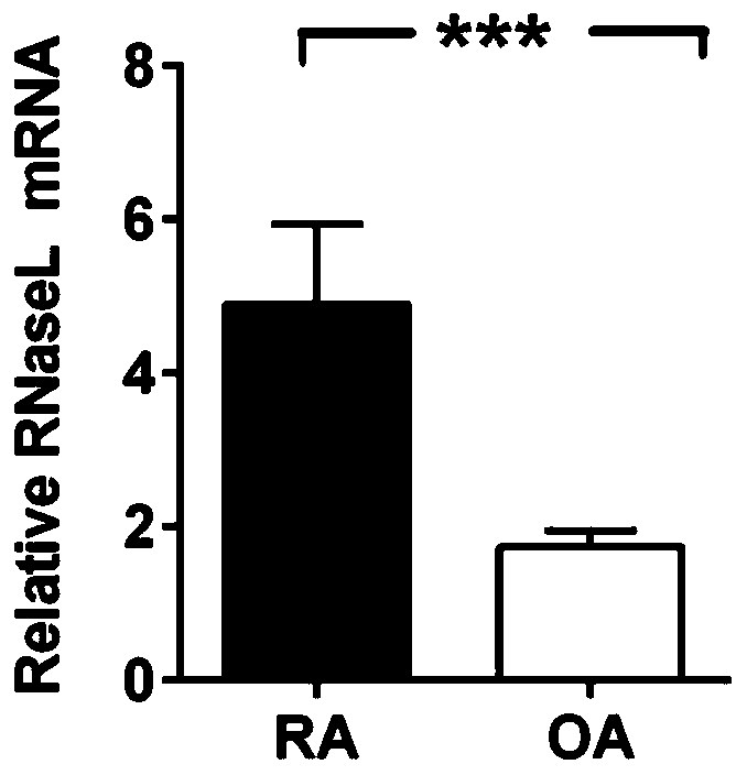 Diagnostic marker of rheumatoid arthritis and application thereof