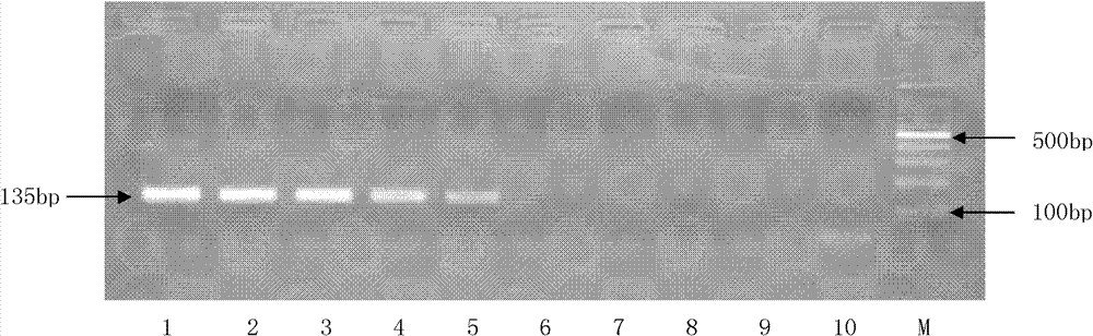 Real-time fluorescent quantitative PCR method used for detecting Mycobacterium tuberculosis, and primer, probe and kit thereof