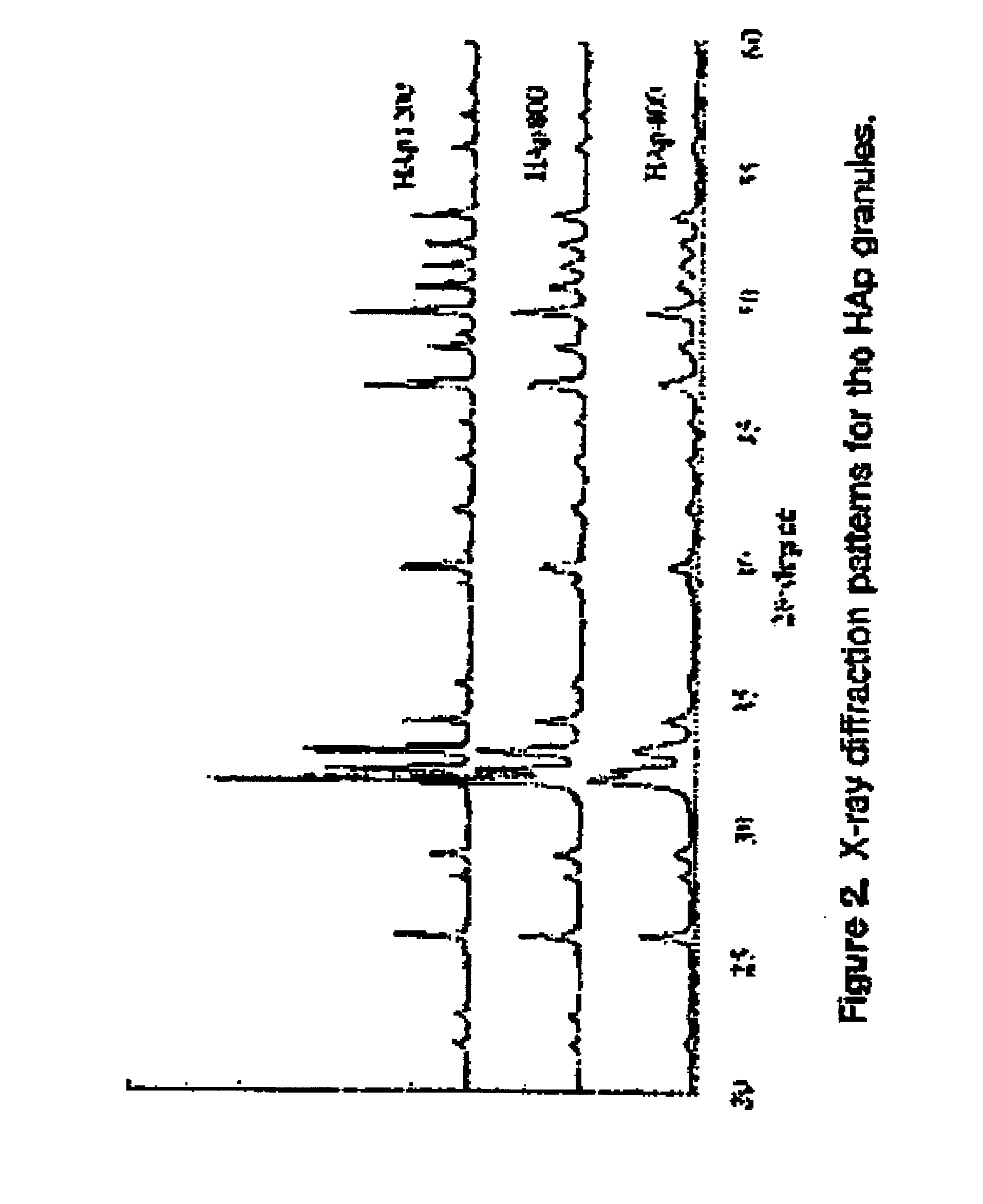 Long term sustained release pharmaceutical composition containing aqueous suspension of bisphosphonate