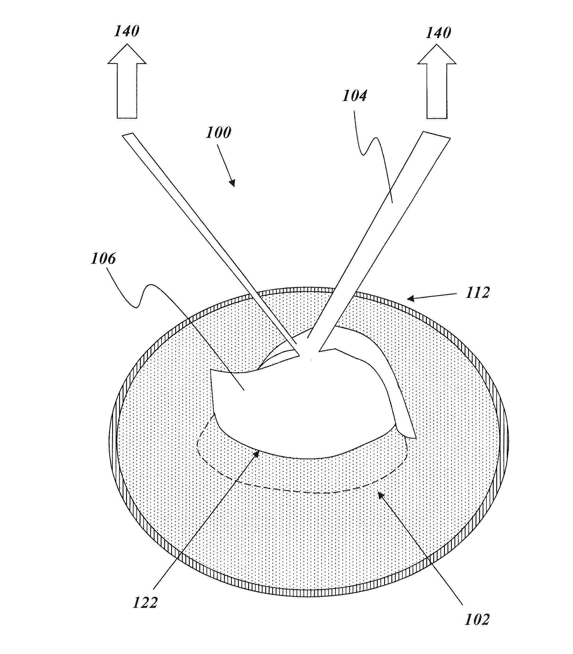 Removable deployment device, system, and method for implantable prostheses