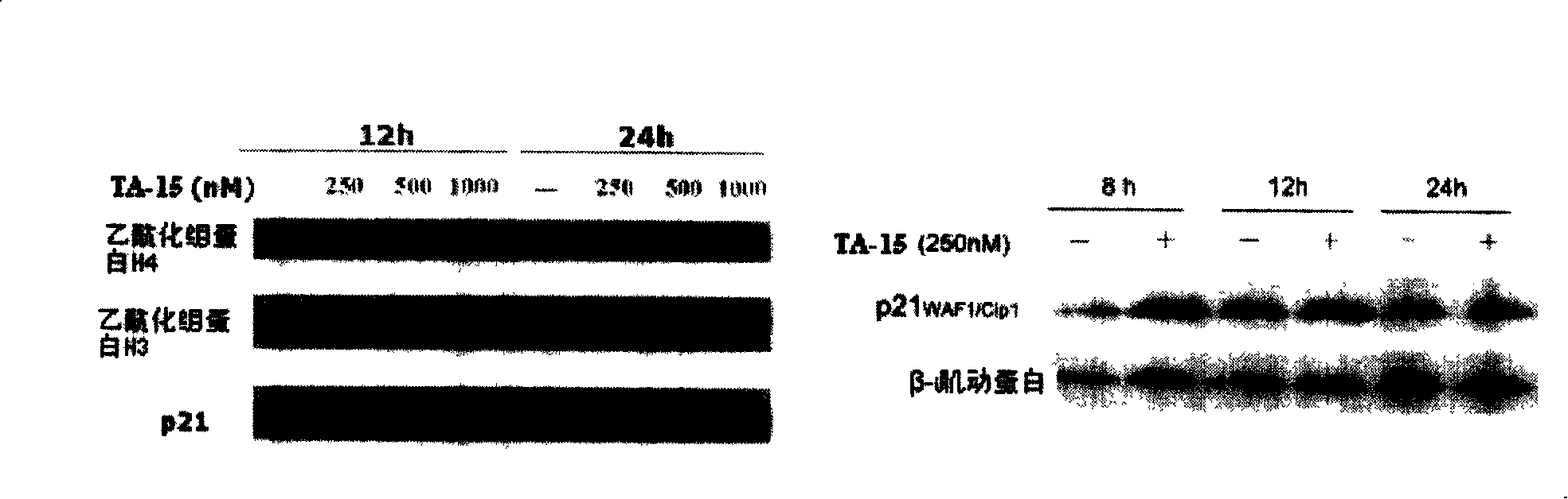 Trichostatin A derivatives, preparation method and use thereof