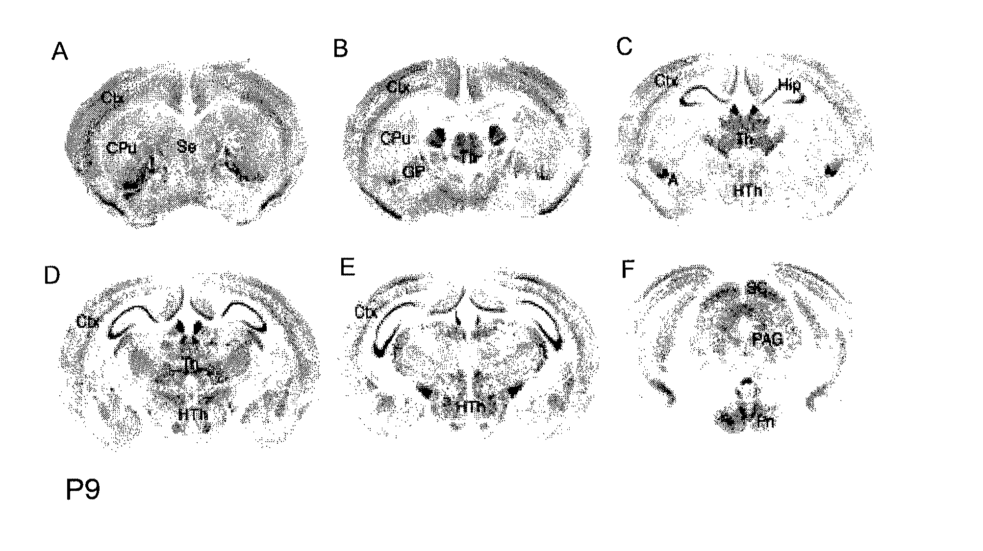 Mutations in Contaction Associated Protein 2 (CNTNAP2) are Associated with Increased Risk for Ideopathic Autism