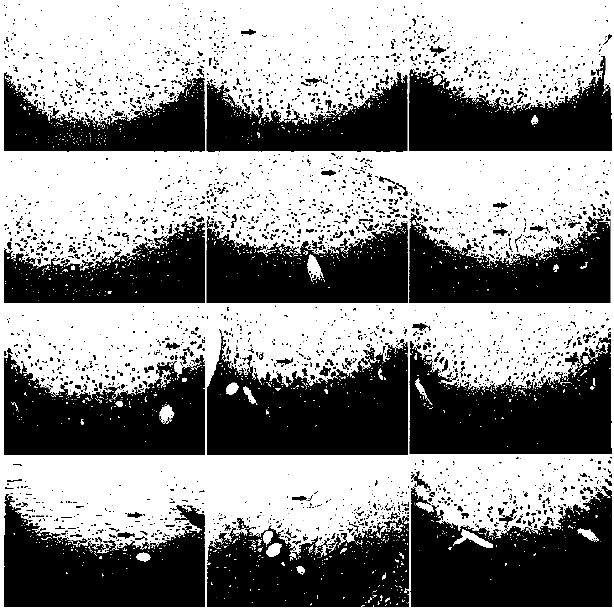 Method for researching influence on angiogenesis in brain of rat suffering from cerebral hemorrhage by high pressure oxygen