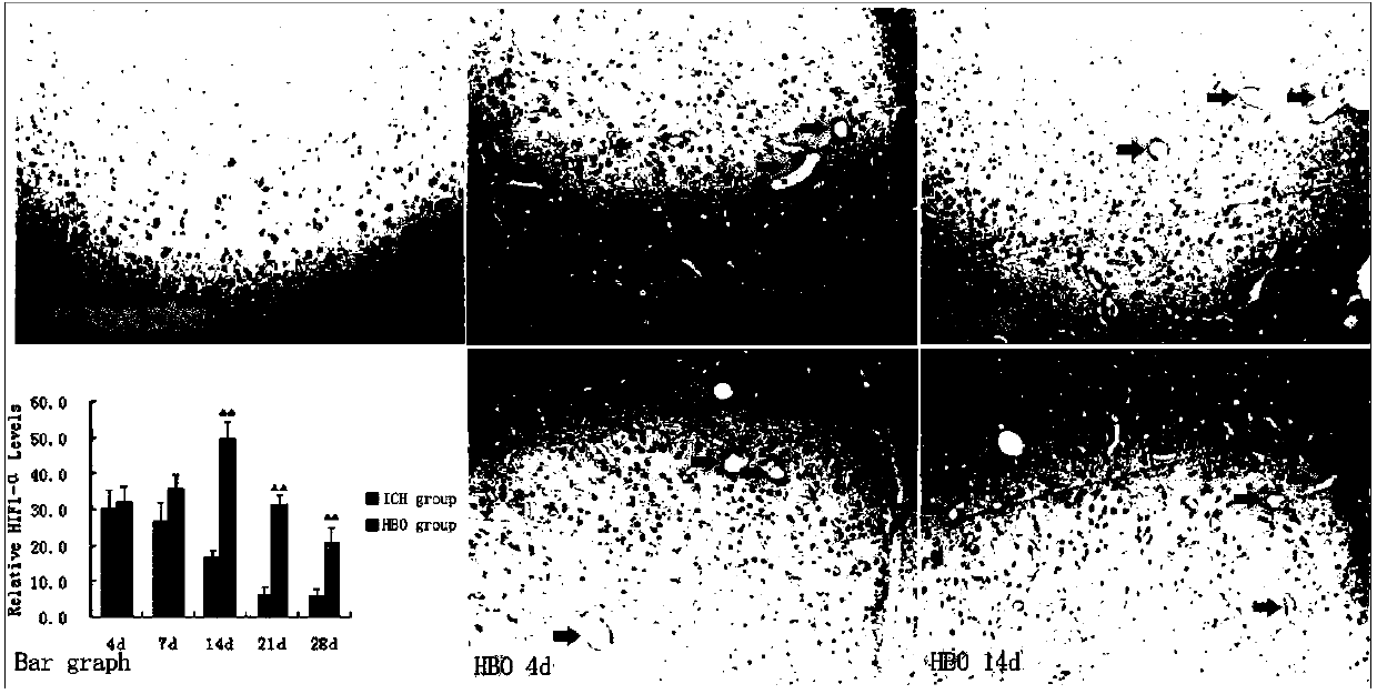 Method for researching influence on angiogenesis in brain of rat suffering from cerebral hemorrhage by high pressure oxygen