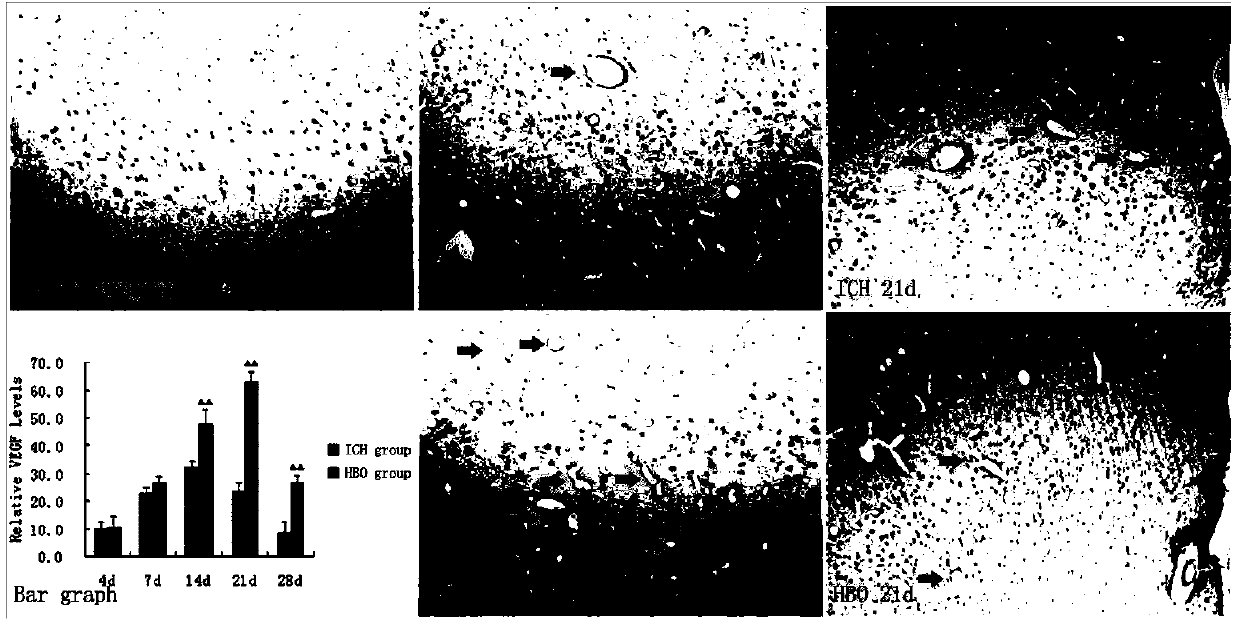 Method for researching influence on angiogenesis in brain of rat suffering from cerebral hemorrhage by high pressure oxygen