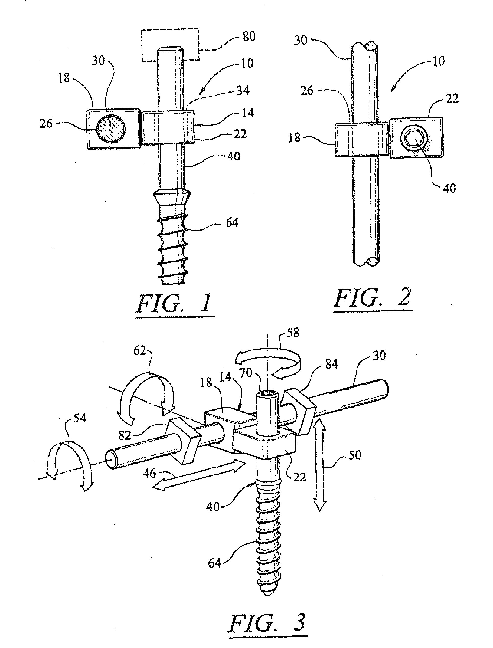 Artificial facet joint and method