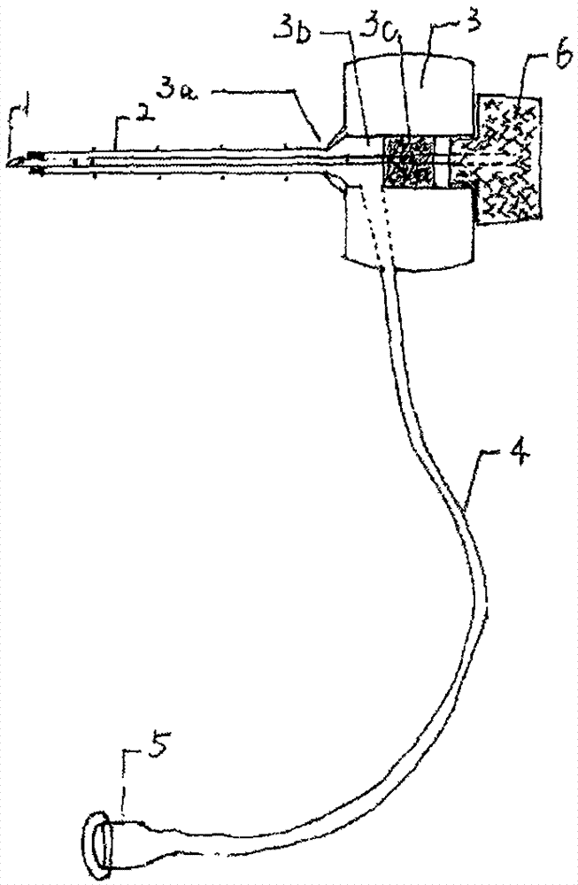 Improved needle special for sacral canal puncture