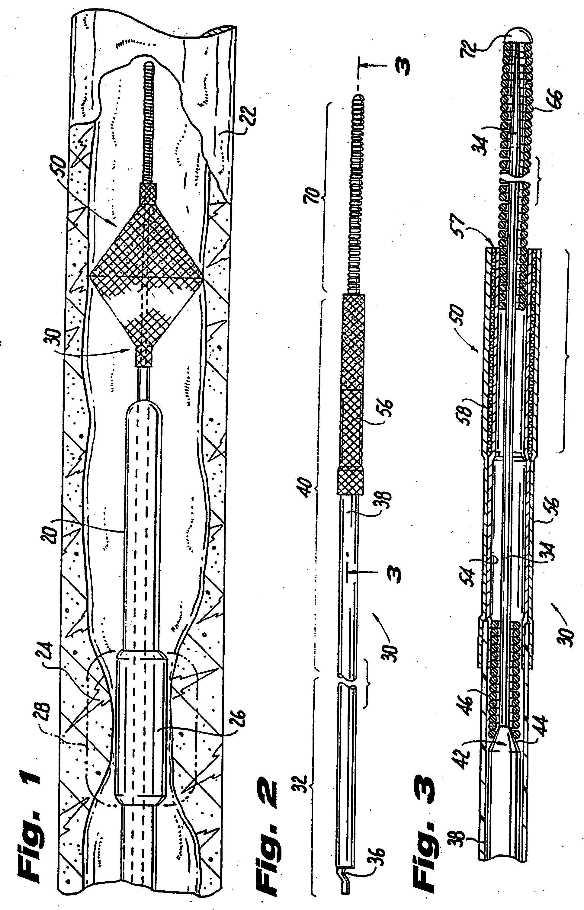 Temporary vascular filter, guide wire