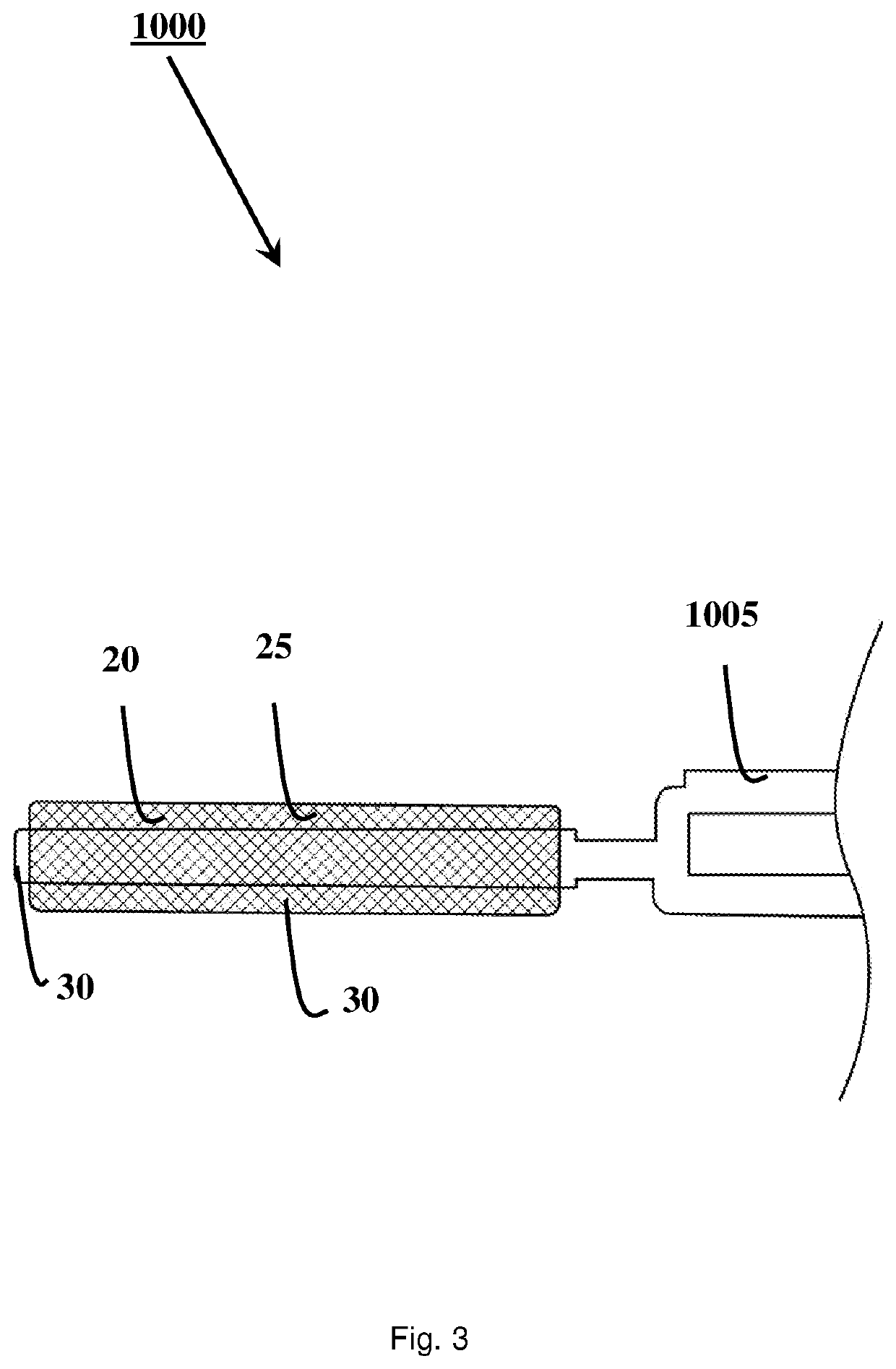 An attachment means for attaching a medical device to tissue, a system for attaching a medical device to tissue, a medical device having an attachment means, a method of attaching a medical device to tissue, and a method of manufacturing an attachment means