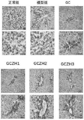 Applications of 3'-geranylchalconaringenin and composition in preparation of products for treating fatty liver