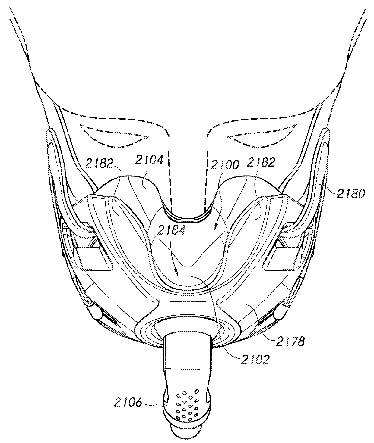 Patient interfaces