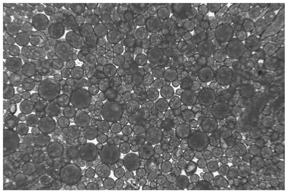 Preparation method of PLGA (poly (lactic-co-glycolic acid)) drug sustained release microspheres