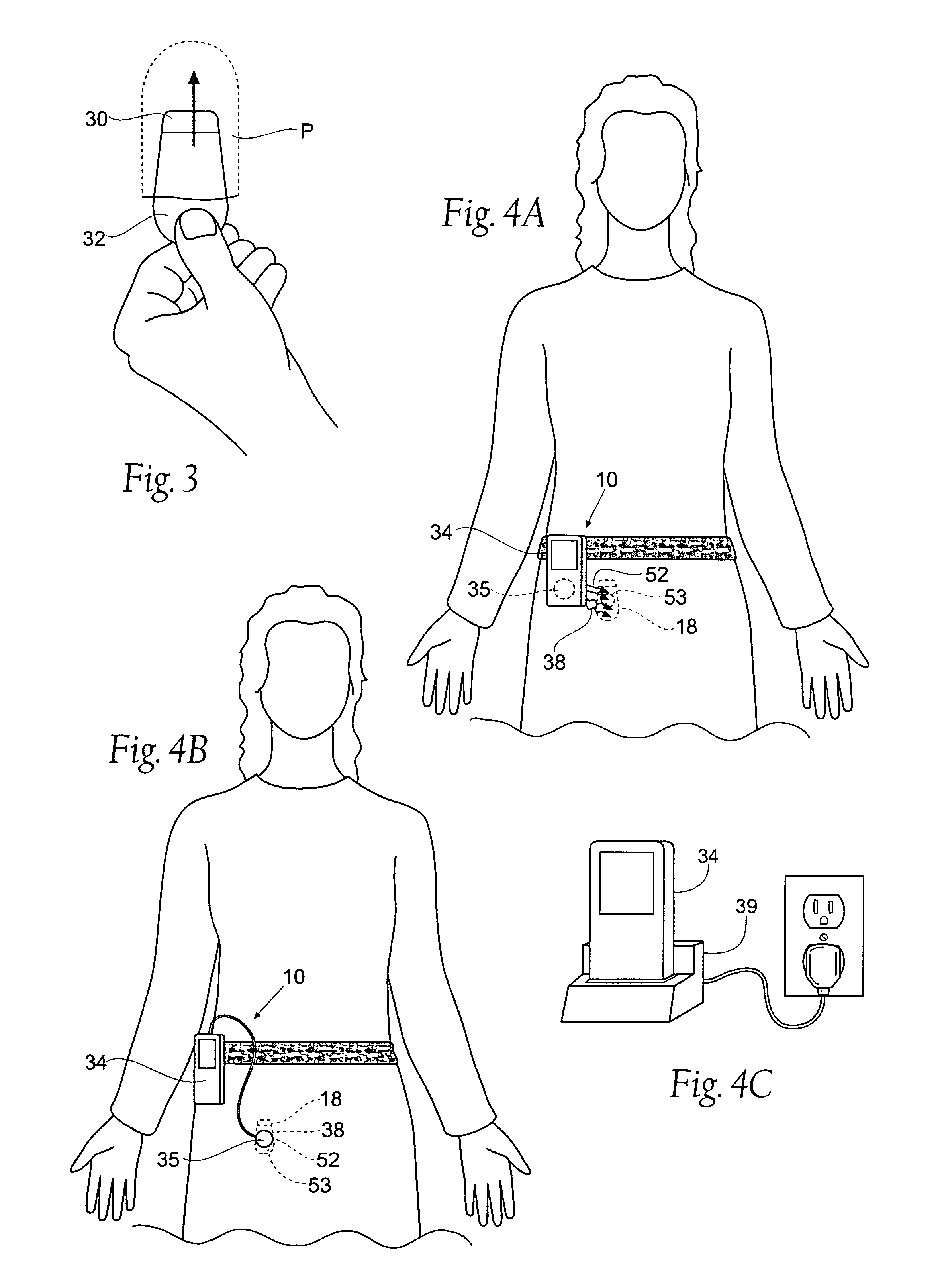 Implantable pulse generator for providing functional and/or therapeutic stimulation of muscles and/or nerves and/or central nervous system tissue