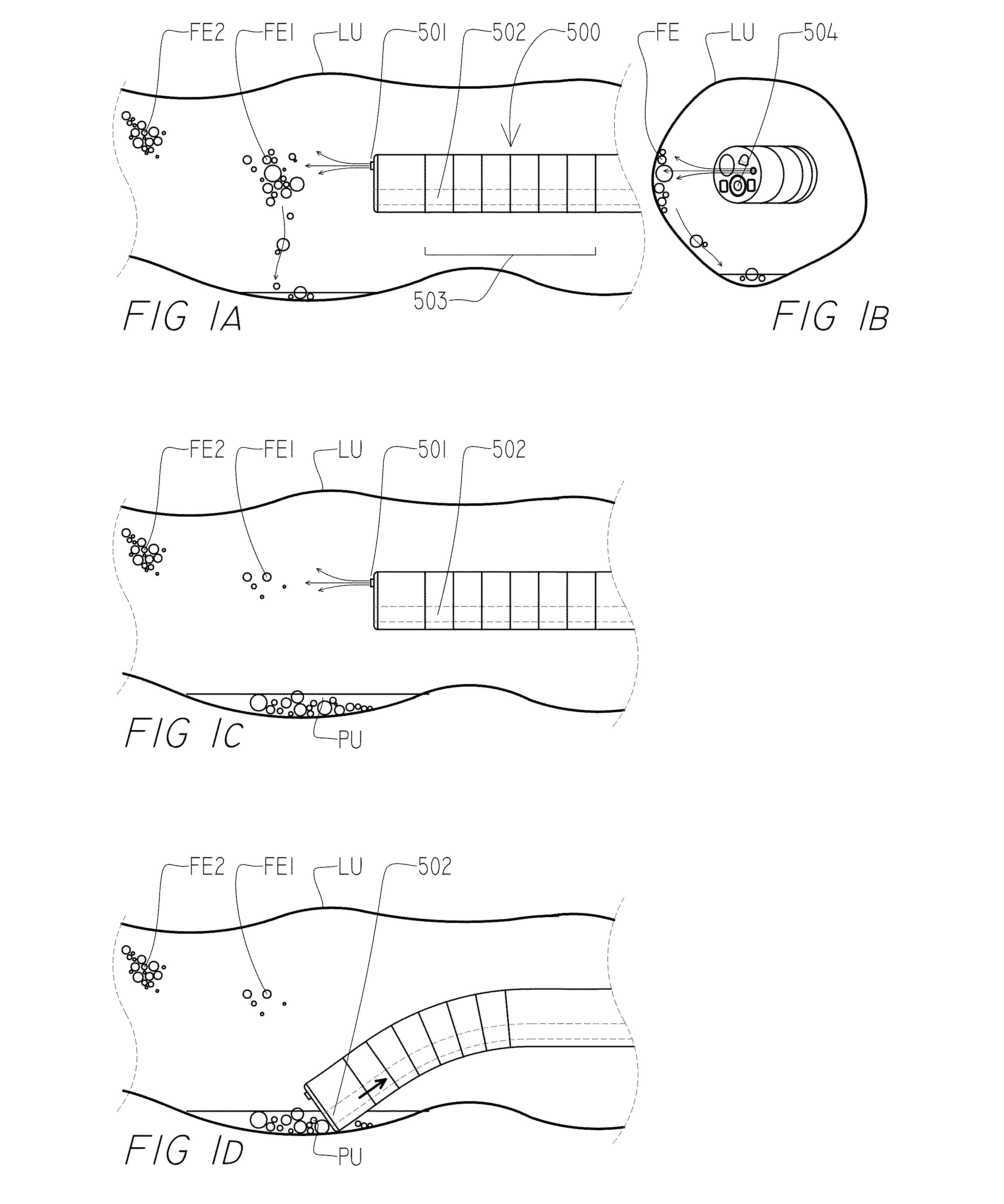 Systems and methods for cleaning body cavities