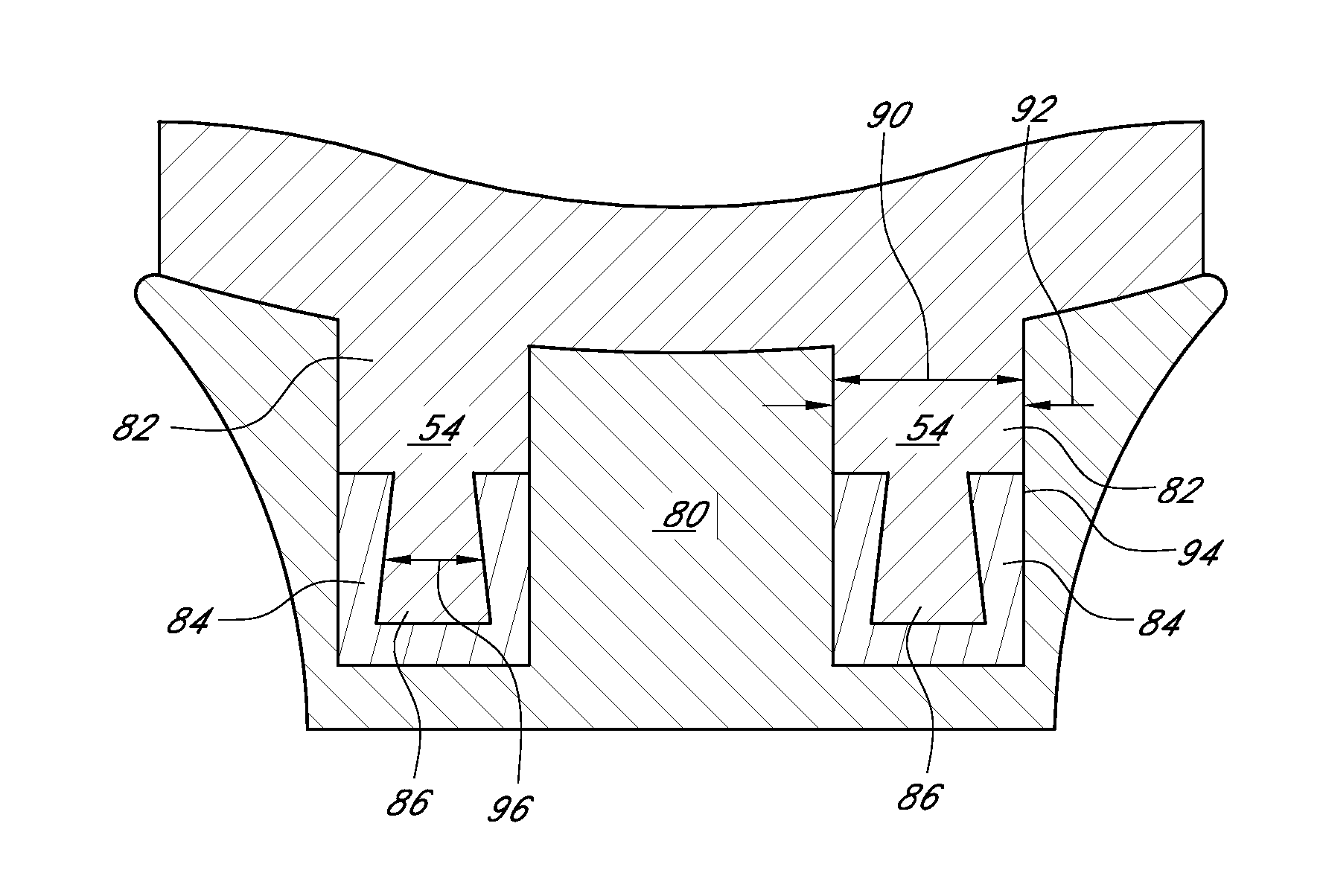 Glenoid component with improved fixation stability