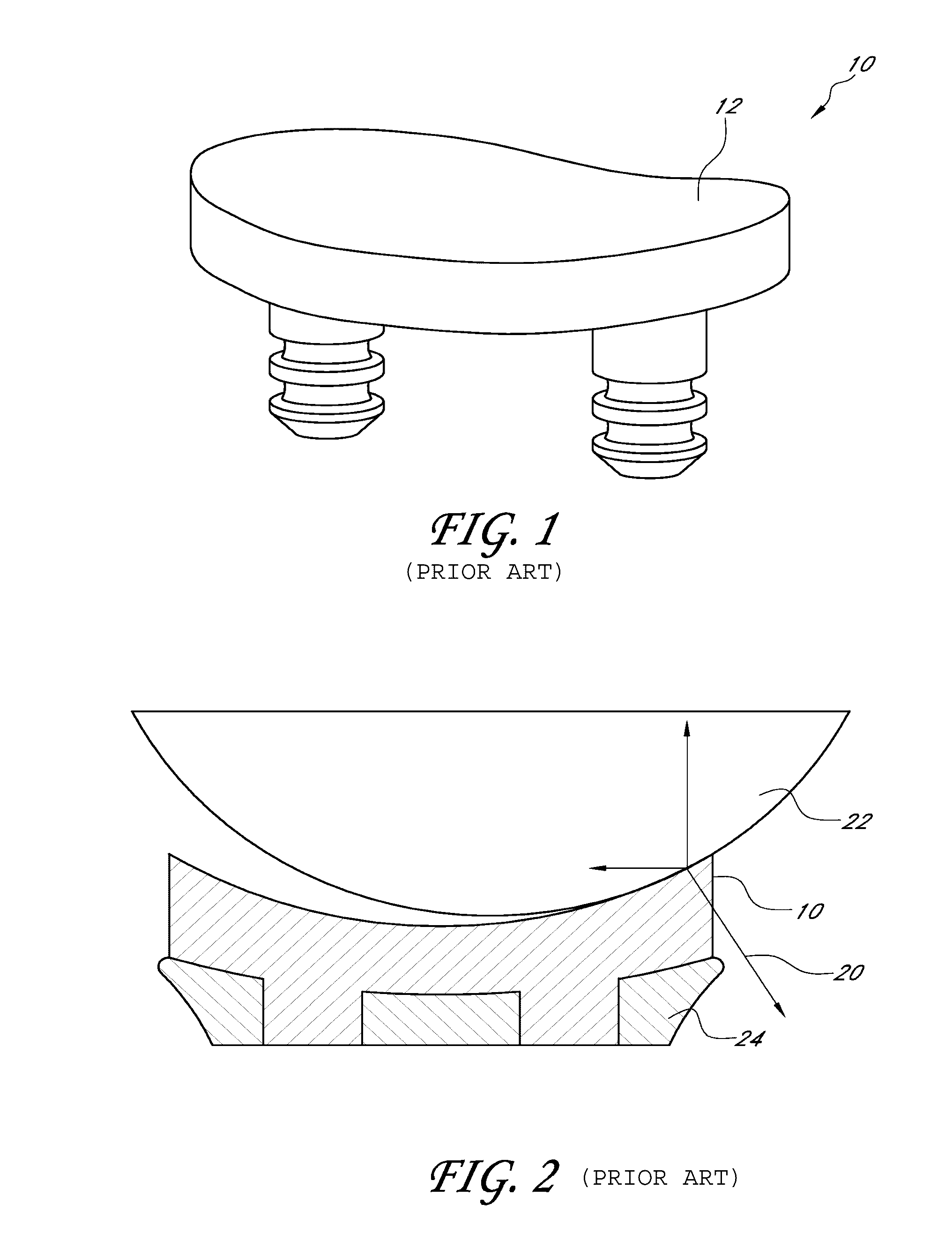 Glenoid component with improved fixation stability