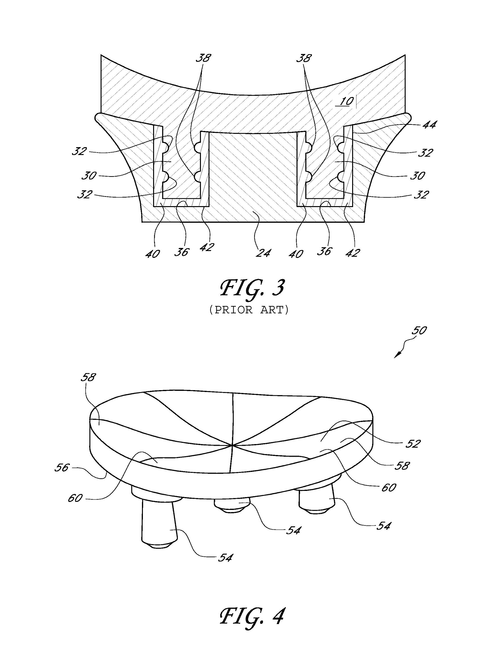 Glenoid component with improved fixation stability