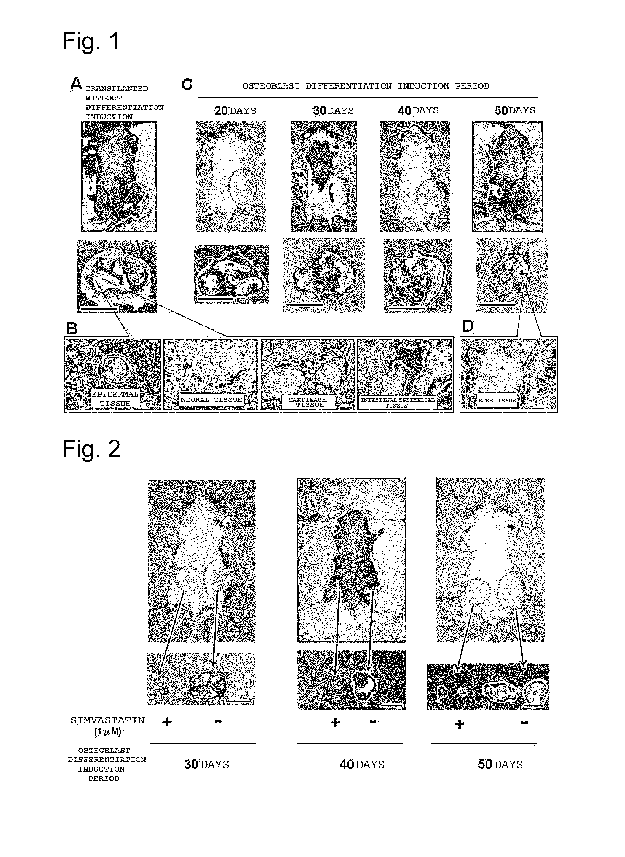 Method for inducing differentiation enabling tumorigenesis of ips cells to be suppressed