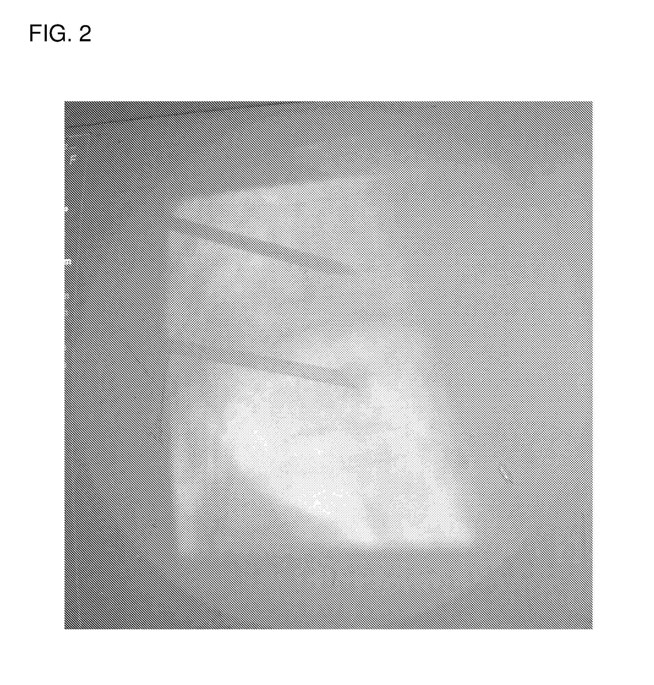 Minimally invasive treatment of vertebra (MITV) using a calcium phosphate combination bone cement