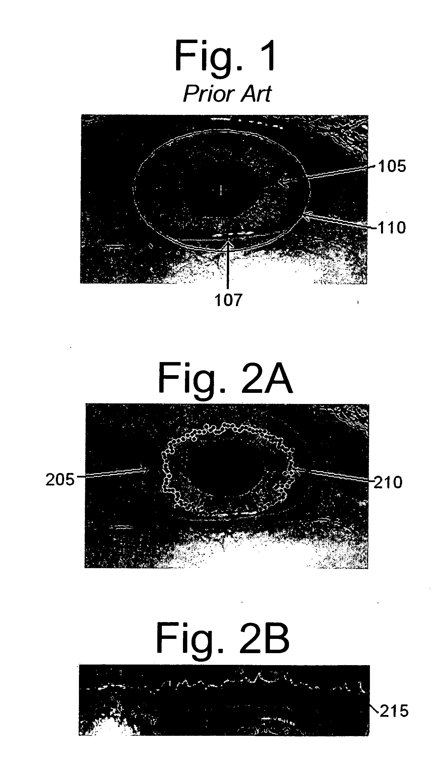 Invariant radial iris segmentation