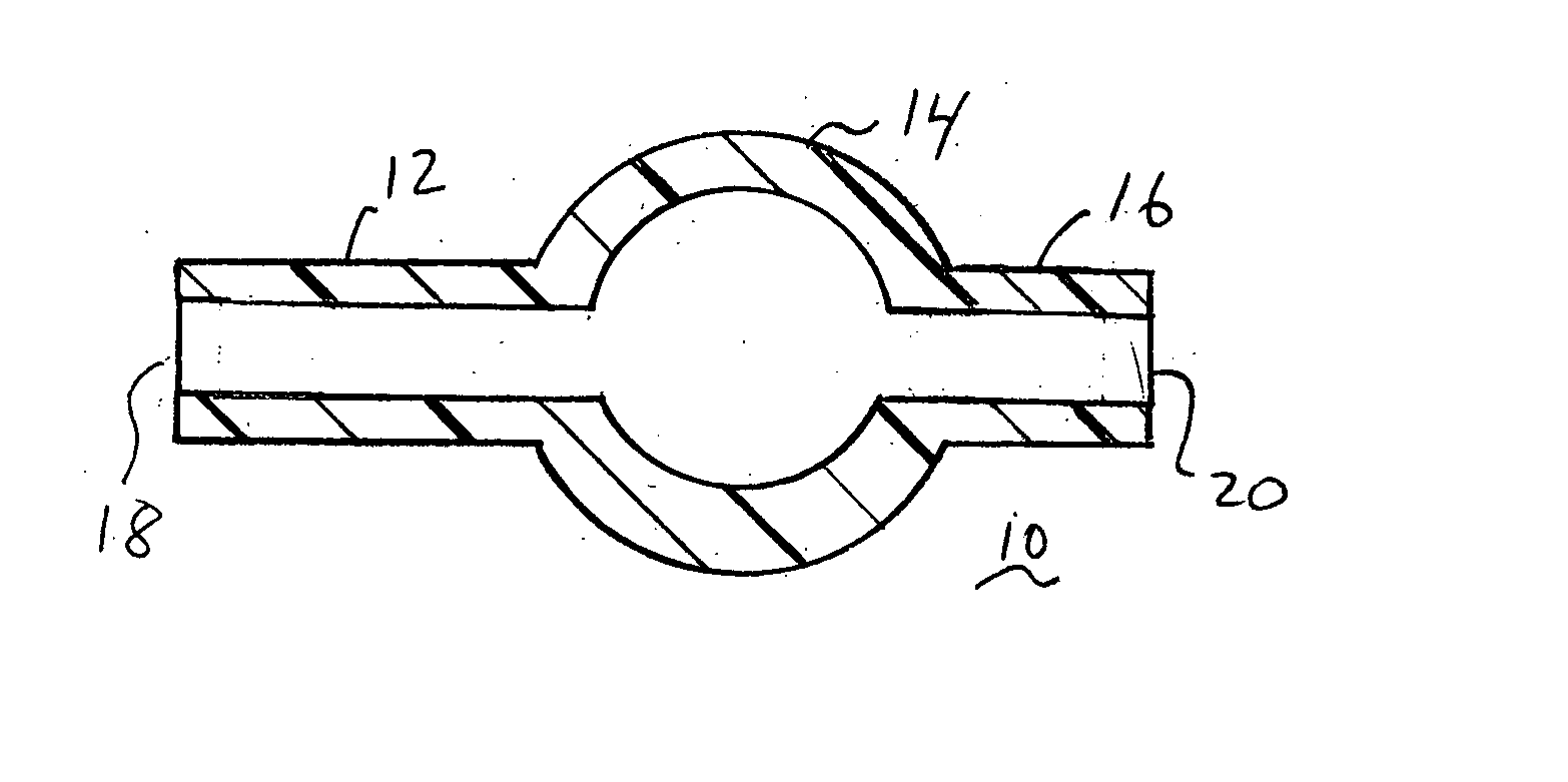 Varied diameter vascular graft