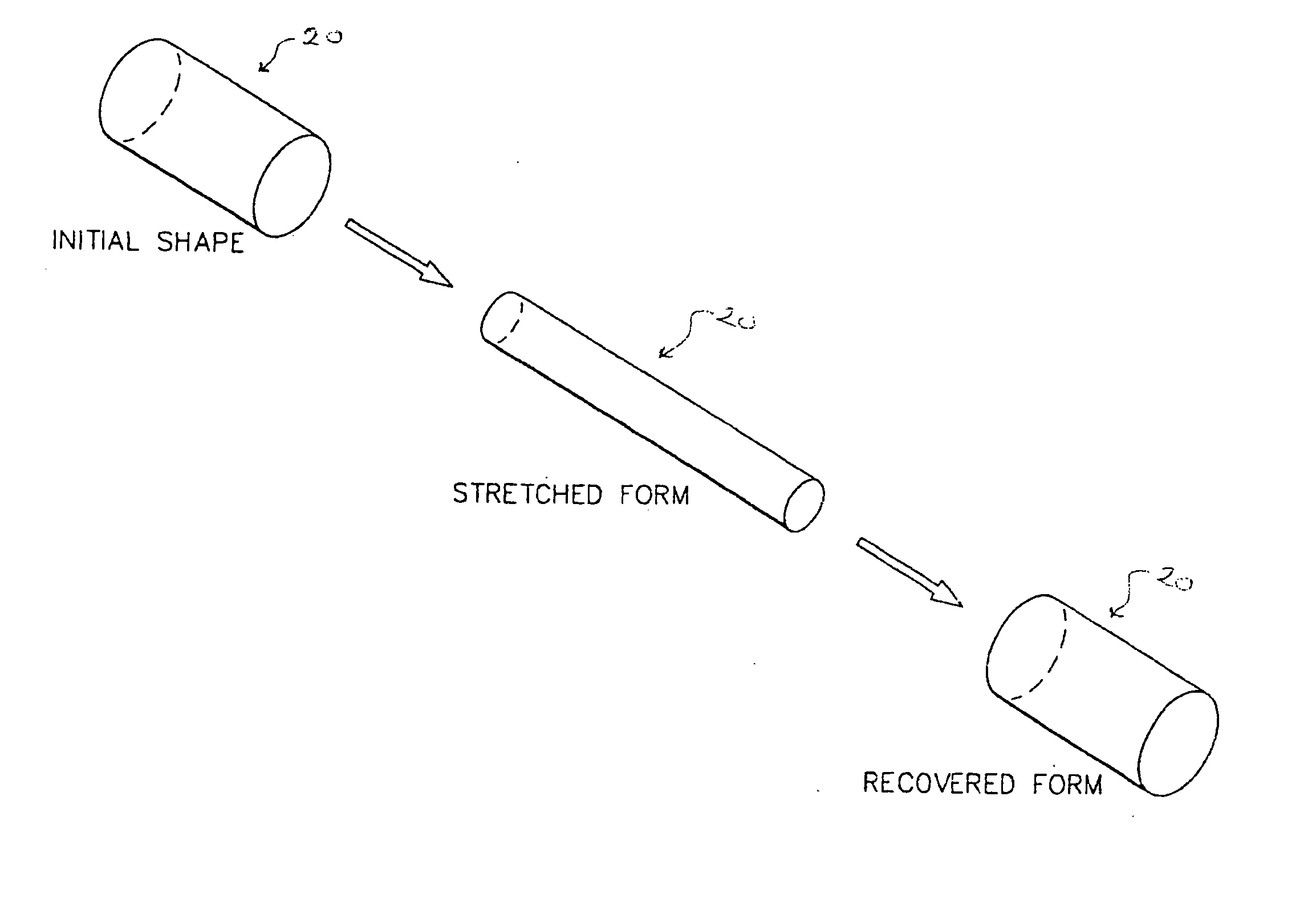 Ocular occluder and method of insertion