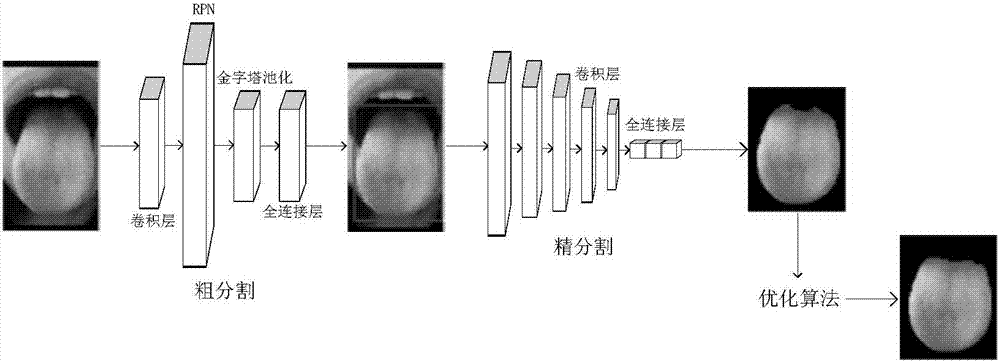 Tongue picture classification method based on multitask convolution neural network