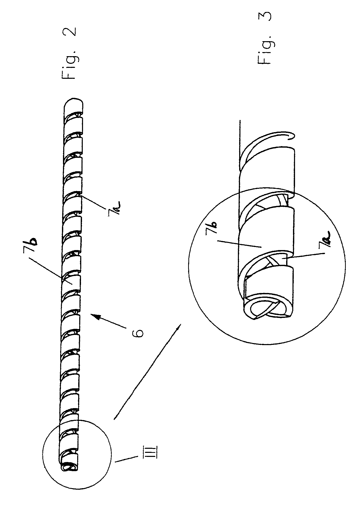 Implant for correction and stabilization of the spinal column