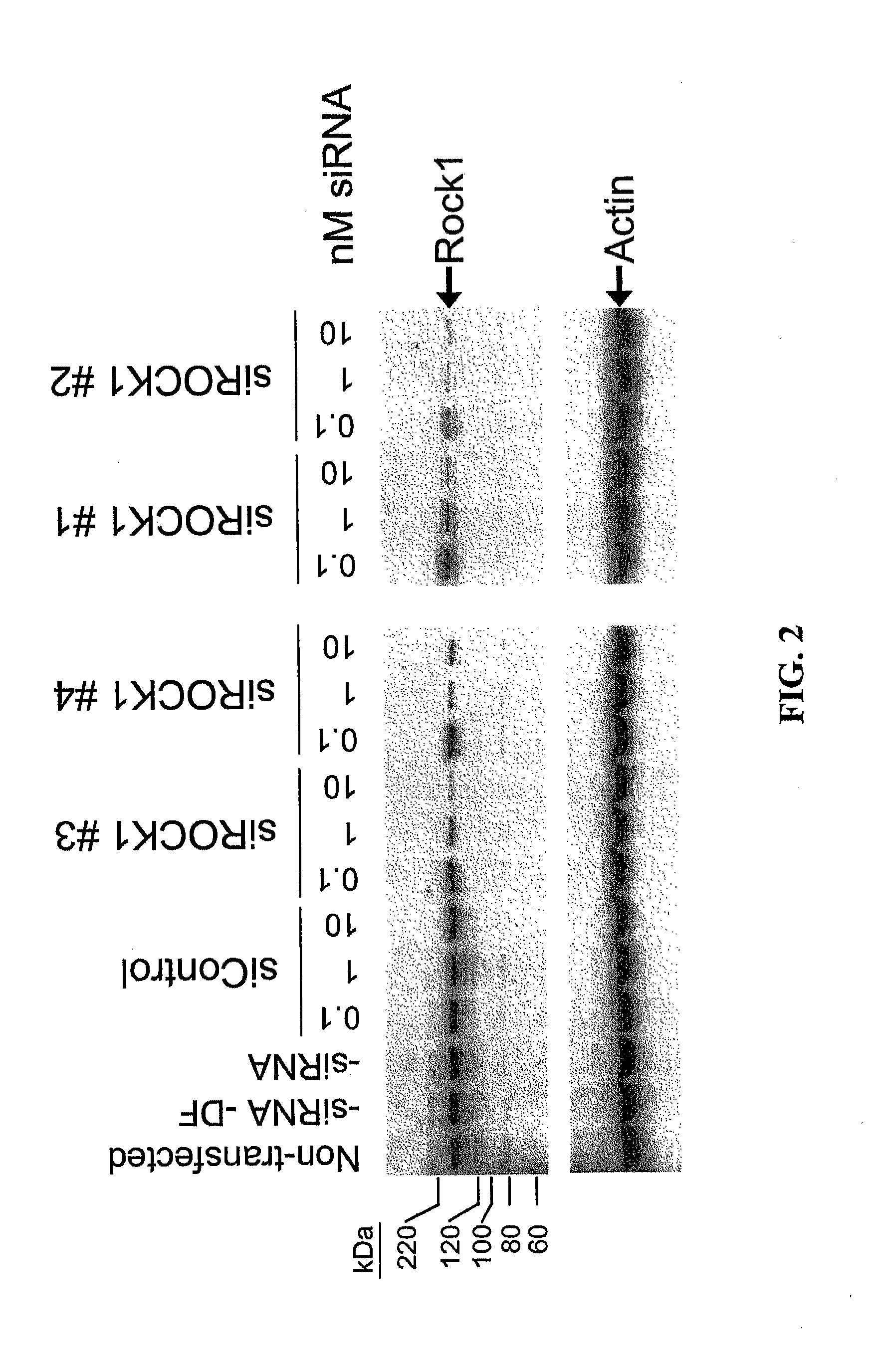 RNAi-Mediated Inhibition of RHO Kinase for Treatment of Ocular Disorders