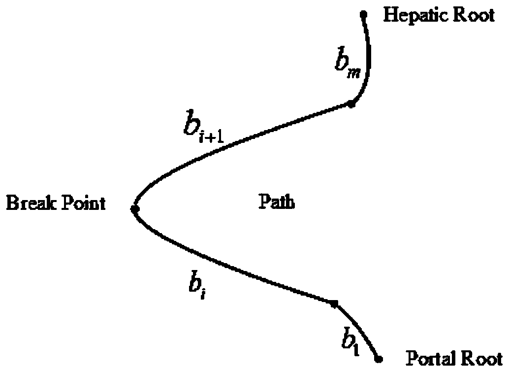 Hepatic vein portal vein separation method and device based on local features