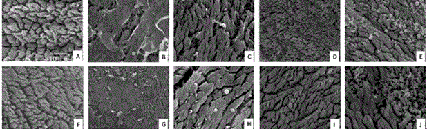 Applications of 18 beta-glycyrrhetinic acid in preparing drugs used for treating allergic rhinitis