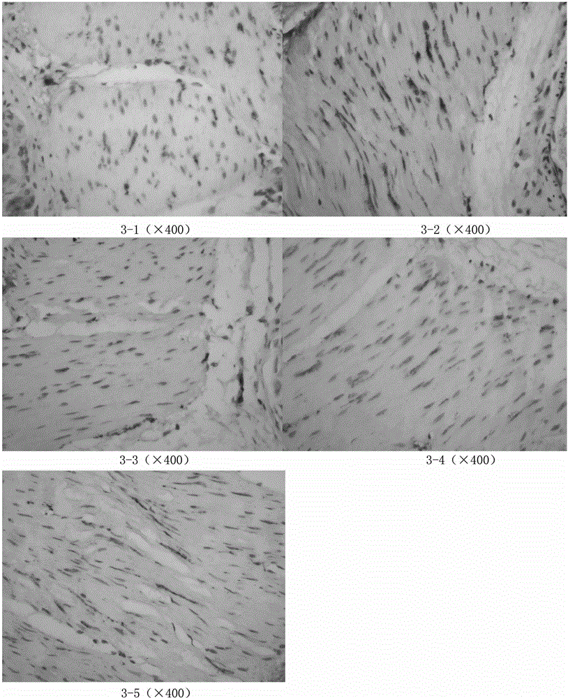 Traditional Chinese medicine preparation for assisting acupuncture treatment of diabetic gastroparesis and preparation method and applications thereof