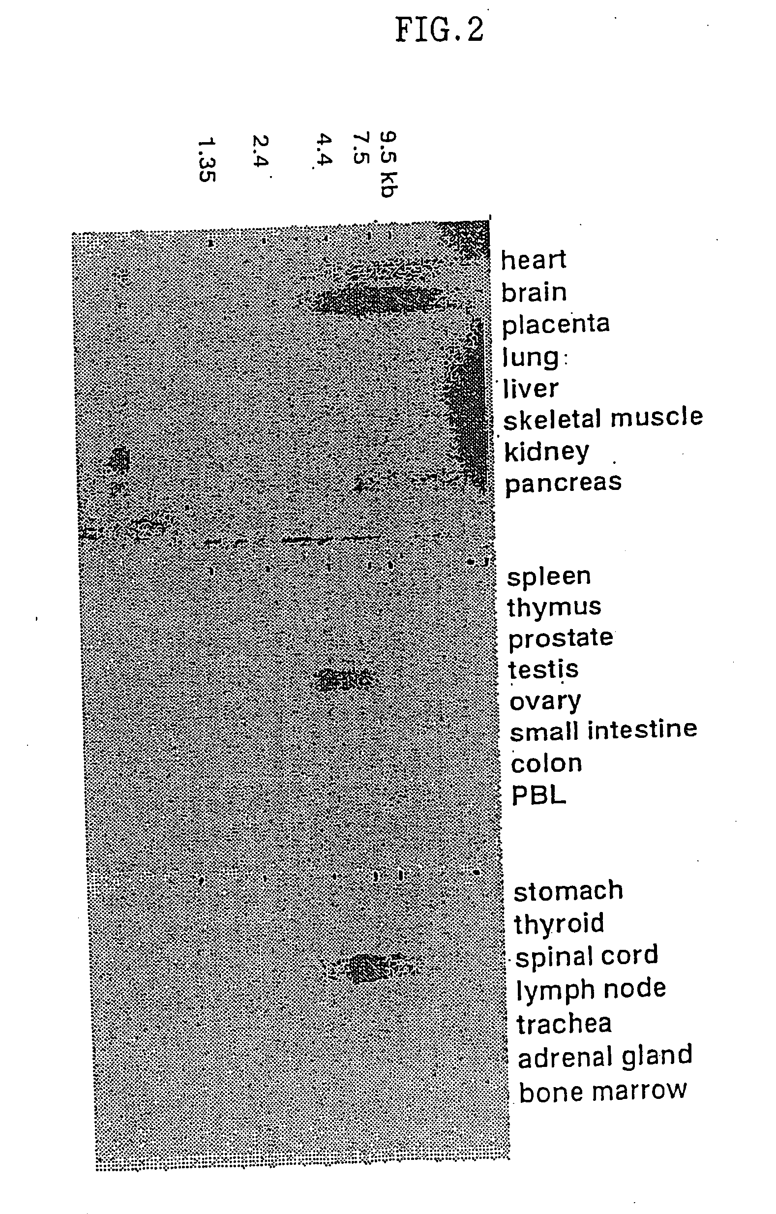 Novel protein, production and use thereof