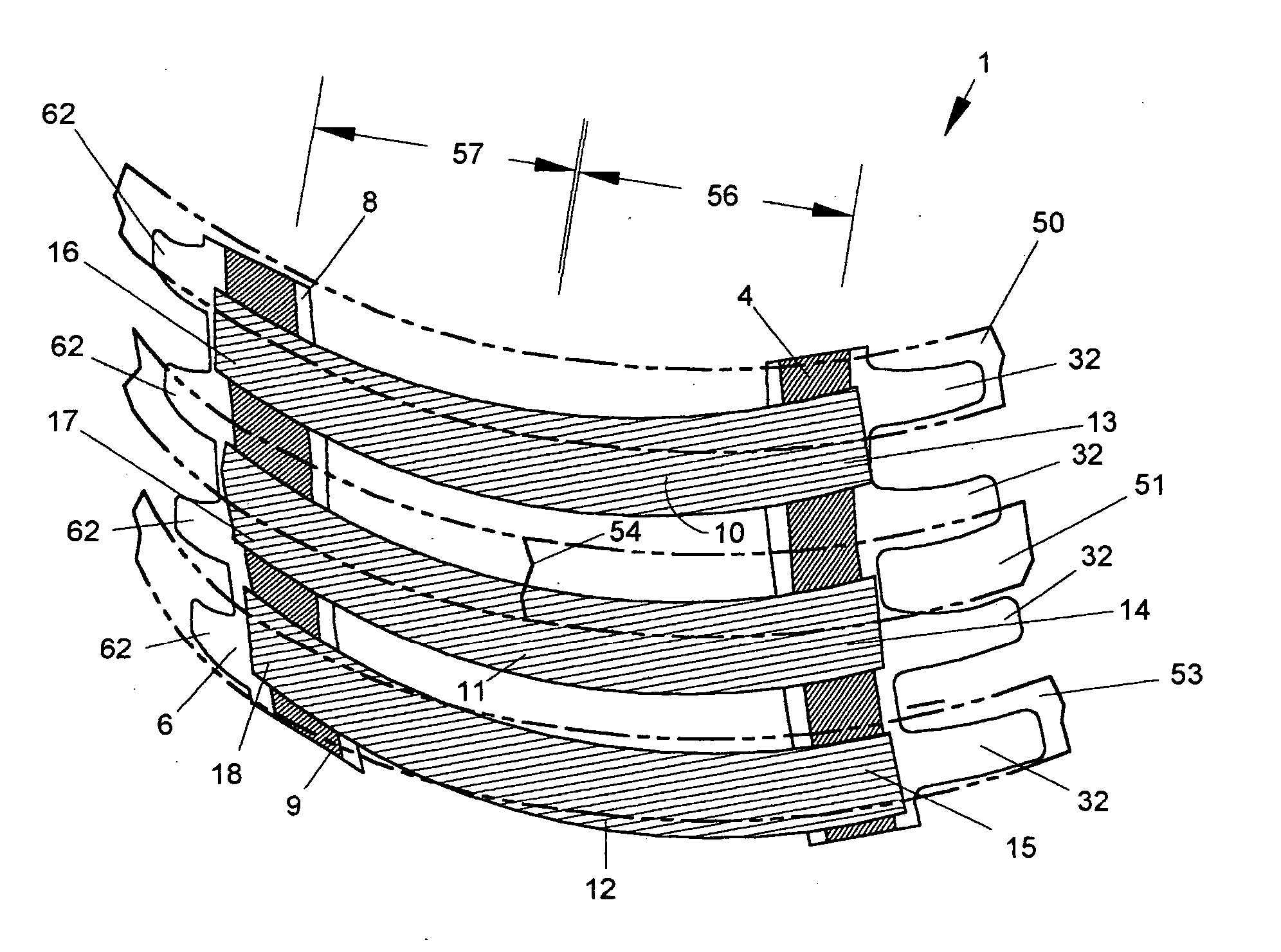 Method for splinting rib injuries