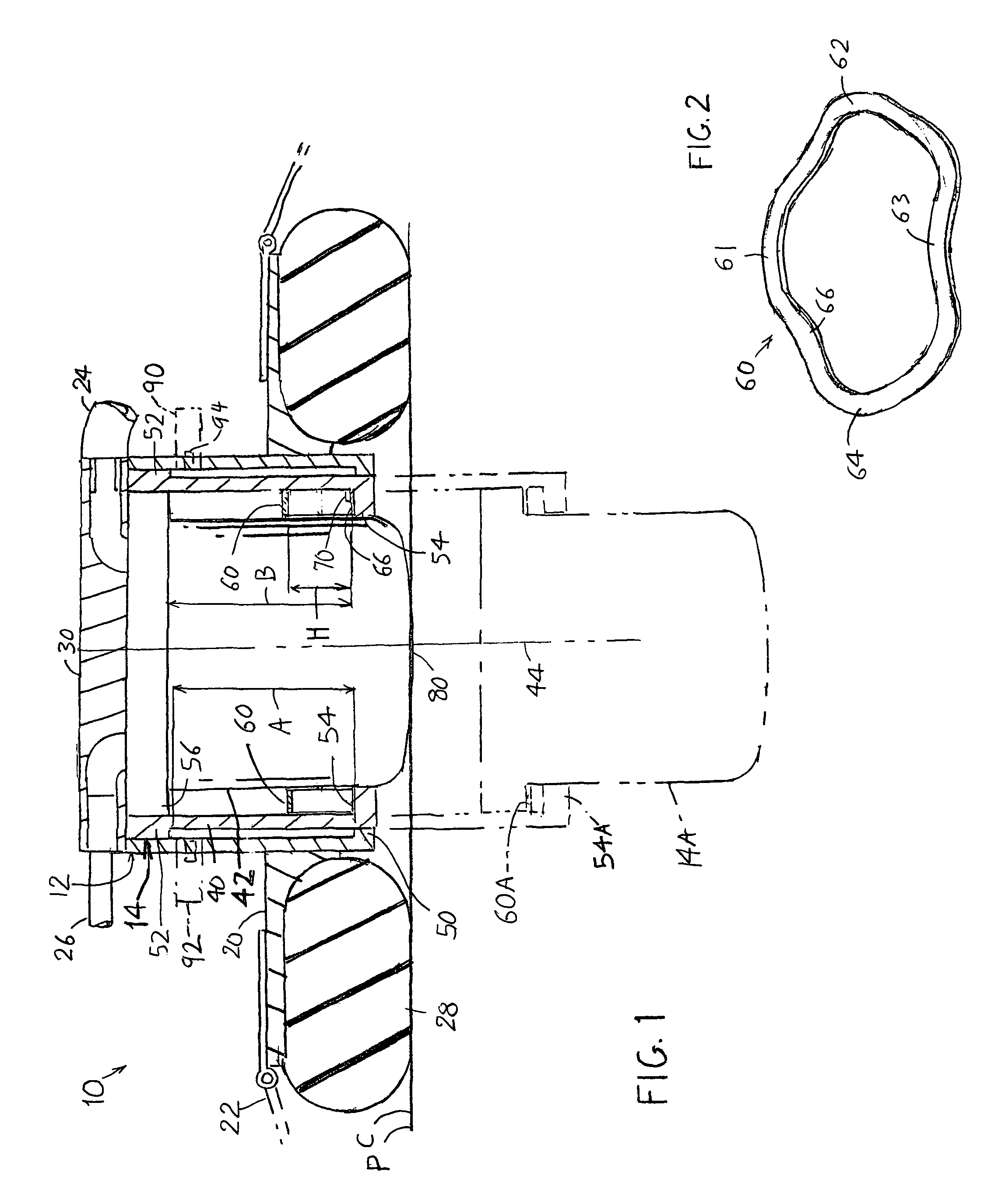 Enhanced chest compressor