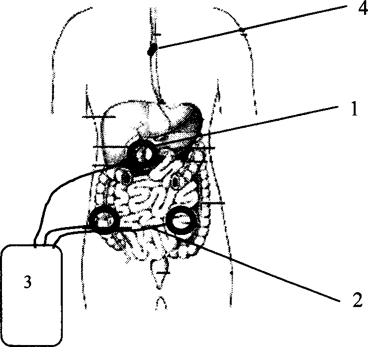 In vitro electro-magnetism excitation positioning system for remotely monitoring capsule swallowed in digestive tract