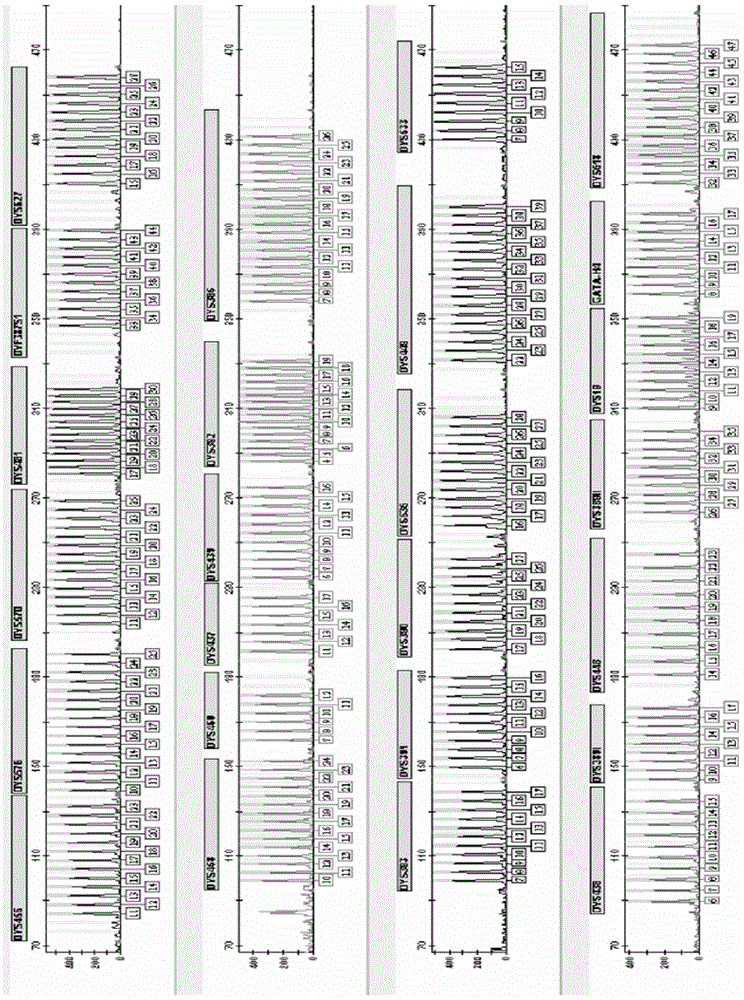 Y-chromosome STR gene locus fluorescence labelled multiplex amplification kit with reinforcing resolution capability and application thereof