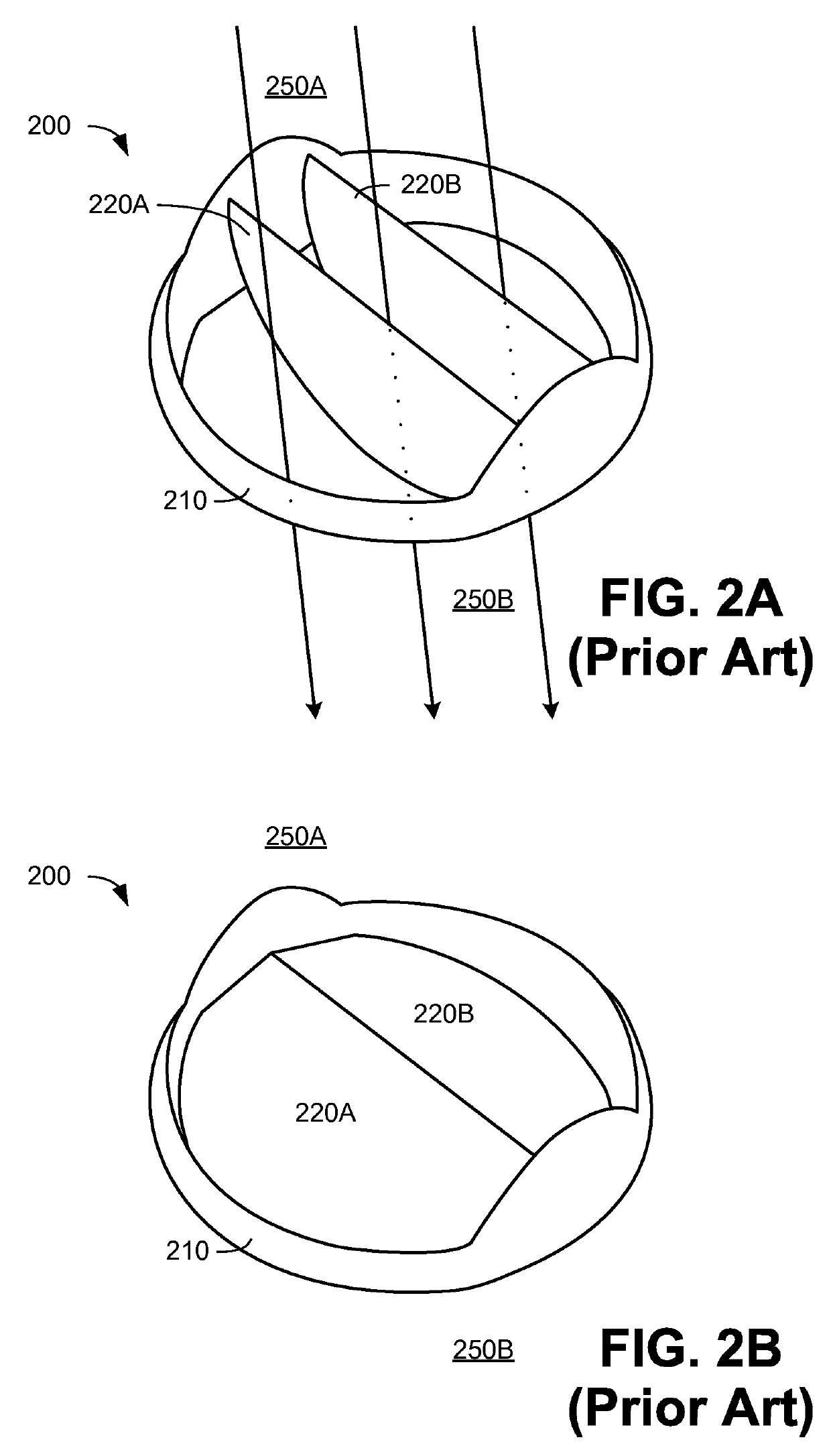 Trileaflet mechanical prosthetic heart valve