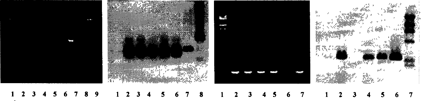 Method for improving beet salt-resistance, draught-resistance and anti-herbicide chlorsulfuron characteristics by multi-gene transformation and application