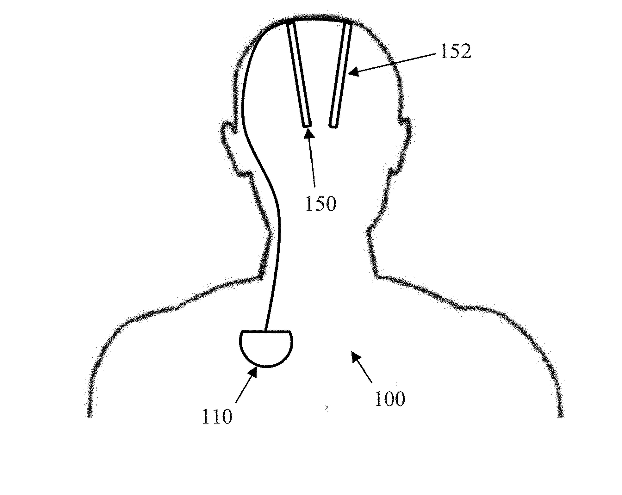 Monitoring Brain Neural Activity