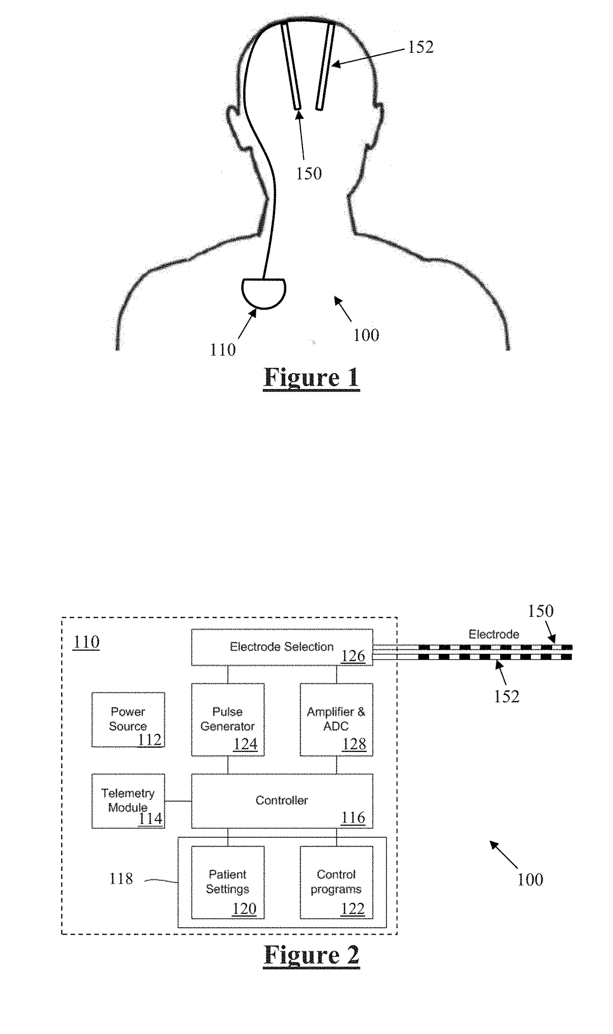 Monitoring Brain Neural Activity